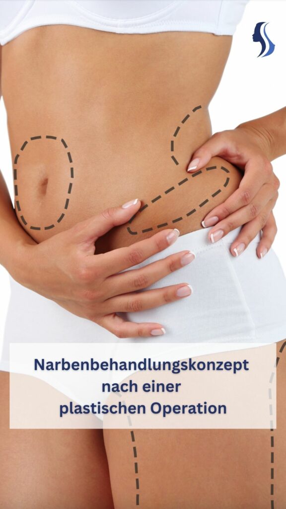 Narben behandeln nach einer Plastischen Operation - ein Video von Dr. med. Jiri Blazek, Facharzt für Plastische und Ästhetische Chirurgie in Berlin