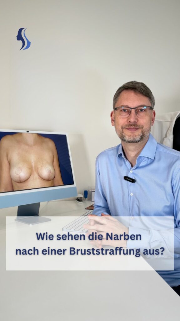 Narben nach einer Bruststraffung - ein Video von Dr. med. Jiri Blazek, Facharzt für Plastische und Ästhetische Chirurgie in Berlin